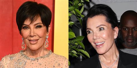 Kris Jenner’s Rep Confirms She Had Plastic Surgery, Doctor Behind New