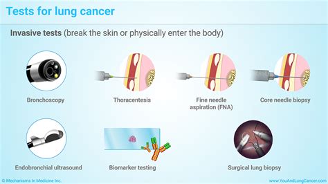 Slide Show Diagnosis And Screening Of Lung Cancer