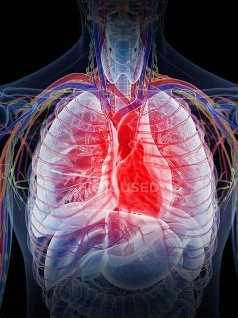 Inflamed Heart In Human Silhouette Computer Illustration — Internal