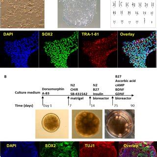 Bulk Rna Seq Using Ipsc Derived Brain Organoids From Three Male