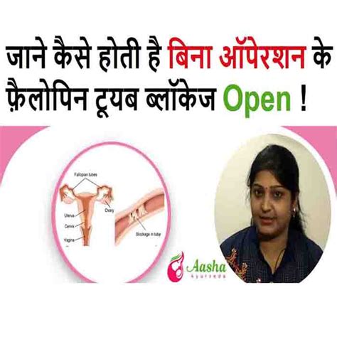 How Can Fallopian Tube Blockage Treatment Without Surgery Aasha