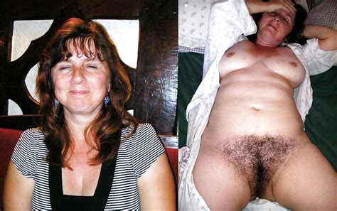 Dressed Undressed Hairy Women Part Porn Pictures XXX Photos Sex Images PICTOA