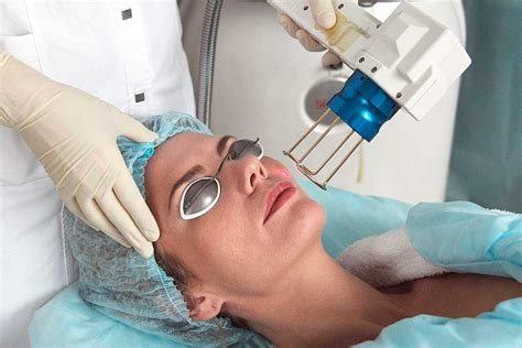 Fraktionierte Co Lasertherapie Sthetische Lasermedizin