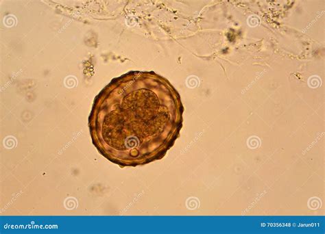 Ascaris Lumbricoides Microscope