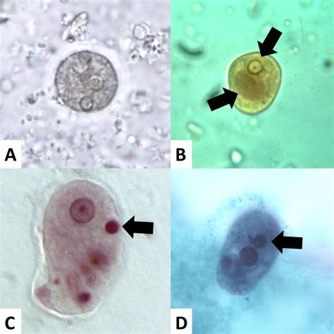 Cisto De Entamoeba Coli O Que É - Partes Do Cisto De Entamoeba Coli Atlas Virtual De Parasitologia