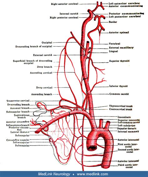 Subclavian Steal Medlink Neurology