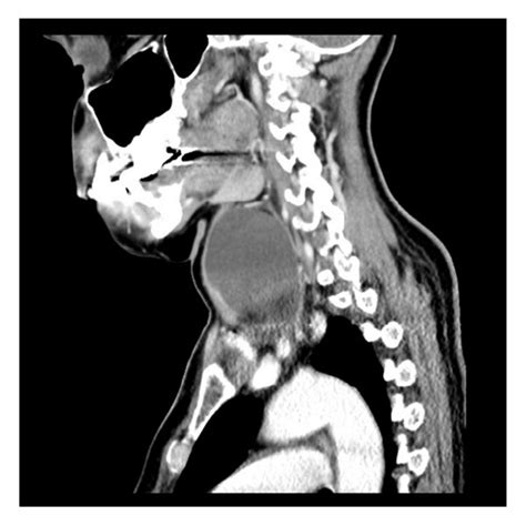 clinical aspects   maxilla  mandible lesions