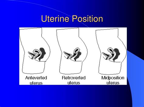 PPT - Gynaecological Ultrasound PowerPoint Presentation, free download