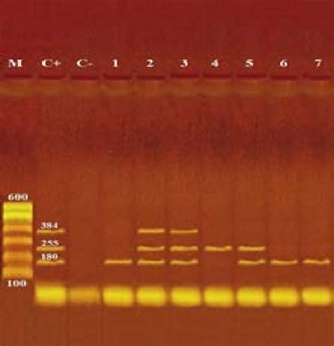 Photograph 1 Agarose Gel Electrophoresis Of Multiplex Pcr Of Stx1