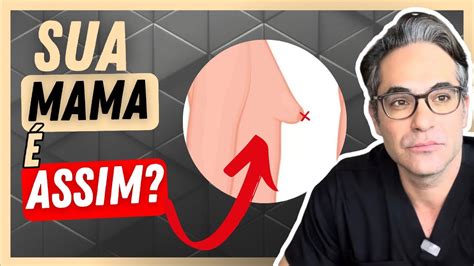 Como Consertar Mama Tuberosas Youtube