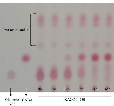 Time Course TLC Analysis Of Metabolites Of Glutamic Acid Bioconverted