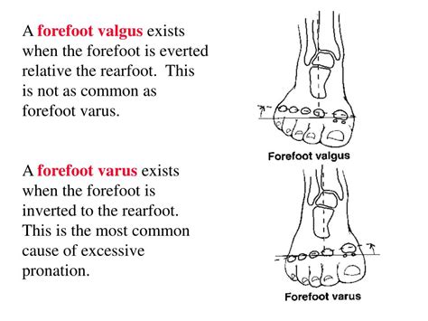 midtarsal joint  calcaneus  cuboid  lateral side