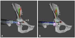 New Hip Safe Sex Motion Study