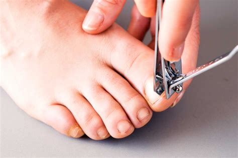 A Review On Toenail Fungus Laser Treatment ModPod Podiatry