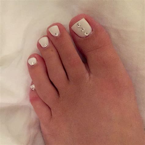 Top 93 Pictures White Marks On Toenails Pictures Completed