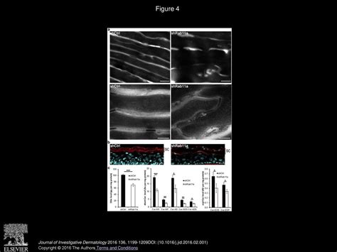 Rab A Is Essential For Lamellar Body Biogenesis In The Human Epidermis