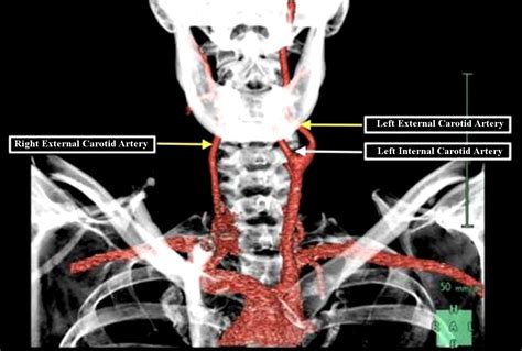 J Med Cases