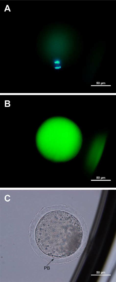 Mature Oocyte Metaphase II MII Stained With Hoechst 33342 A And