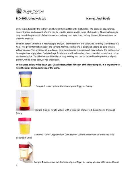 BIO 202L Activity 3 Urinalysis Lab BIO 202L Urinalysis Lab Name Andi