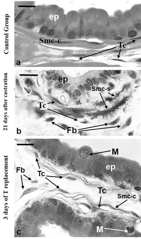 Resin Embedded Sections Of Rat Ventral Prostates From The Three