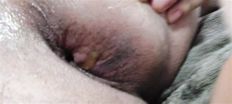 Hole Polish Gay Gaping Gaping Porn XHamster