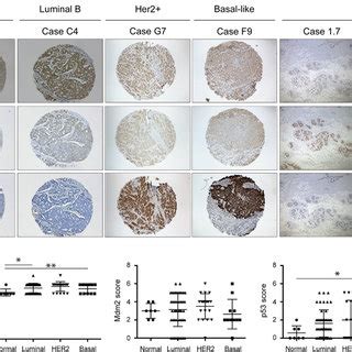 Elevated Mdmx Expression Inversely Correlated With P Levels Tma From