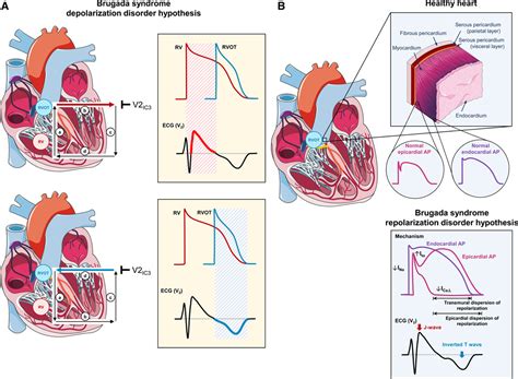 Sex Related Differences In Cardiac Channelopathies Circulation