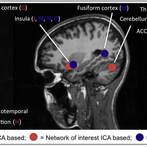 Main Brain Areas Implicated In Resting State Functional MRI Diagram Of