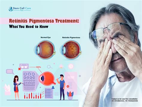 Retinitis Pigmentosa What Is Retinitis Pigmentosa? — Foundation