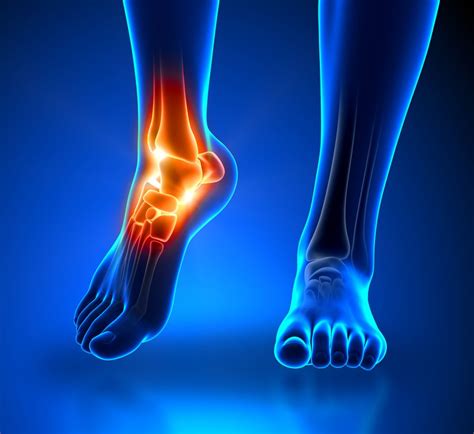 Ankle Pain: Symptoms, Causes and Treatment | STD.GOV Blog