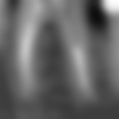 Апикальная дельта и латеральные каналы Выглядит на снимке очень КРУТО ...