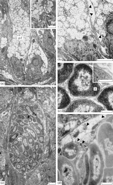 Ultrastructure Of Glandular Cells And Cells With Bacteria In The