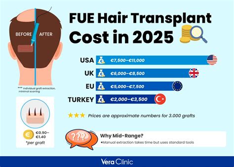 Hair Transplant Cost How Much Is A Hair Transplant Vera Clinic