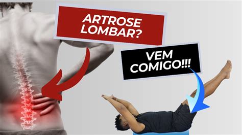 Os Melhores Exerc Cios Para Aliviar A Artrose Lombar Cuide Da Sua