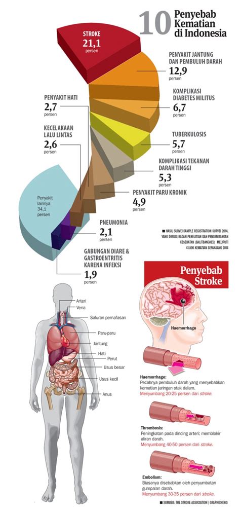 Stroke Penyebab Kematian Tertinggi Di Indonesia Gaya Hidup Koran My Riset