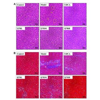 Histological Analysis A Hematoxylin And Eosin H E Stained Sections