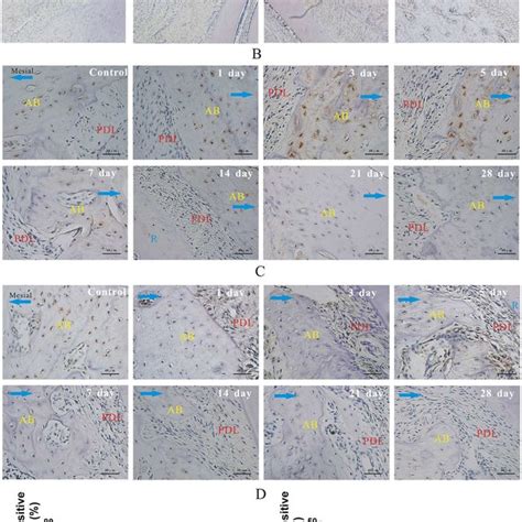 Sclerostin Enhanced Rankl Expression And Osteoclastic Inducible Ability