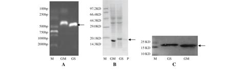 Construction Expression And Identification Of GM CSF SS A DNA