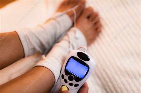 Physical Therapy With Tens Machine Stock Image F0277320 Science