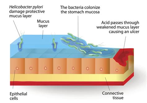The 7 Core Strategies to Heal Leaky Gut and Fuel the Biome - Dr. Alex