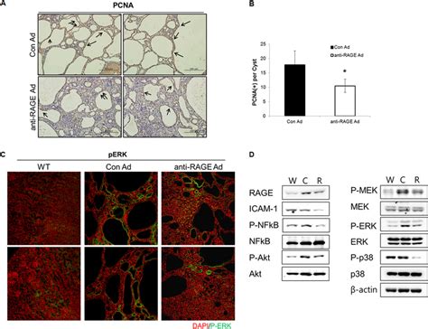 Cell Proliferation In Pc R Mice Attenuated By Down Regulation Of Rage