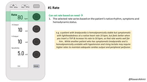 transvenous pacing