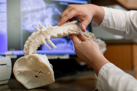 Opciones De Tratamiento De La Escoliosis Red De Noticias De Mayo Clinic