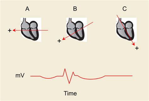 Solved Consider the idealized ECG trace shown in the | Chegg.com