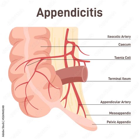 Appendix Anatomical Diagram With Large Intestine Caecum And Ileum