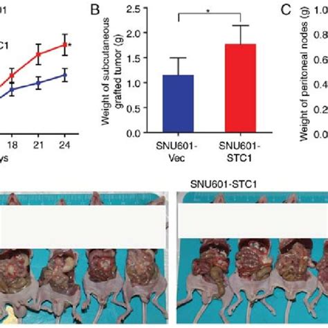 STC Promotes Tumor Growth And Metastasis In Nude Mice A Volume Of