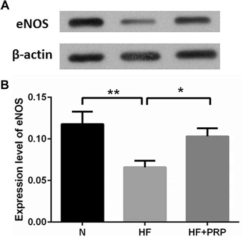 Western Blotting For Endothelial Nitric Oxide Synthase Enos A Enos Download Scientific