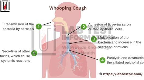 Whooping Cough disease