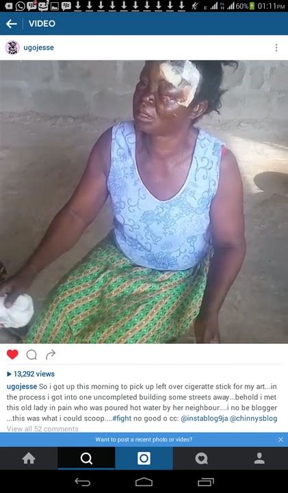 Lady Pours Hot Water On Her Neighbour Almost Blinded Her Photos Crime Nigeria