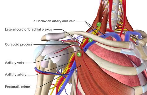 Thoracic Outlet Syndrome | Concise Medical Knowledge